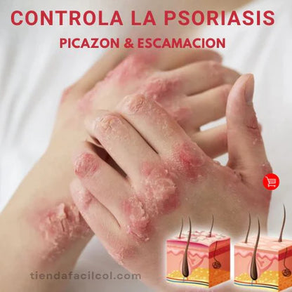 (X2) Psoriasis Treatment Spray