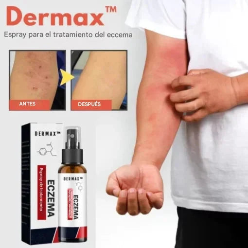 (X2) Psoriasis Treatment Spray